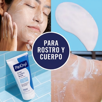 PanOxyl 4% Benzoyl Peroxide Acne Creamy Wash, limpiador facial y corporal para el acné 170 g